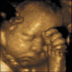 Baby in womb rubs its eye.