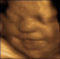A baby smiles in the womb.